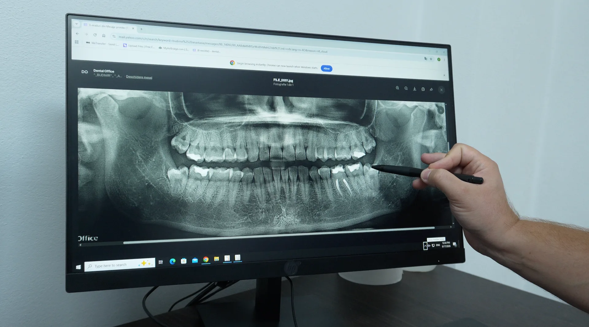 radiografii și ct dentar în moldova nouă și peciu nou